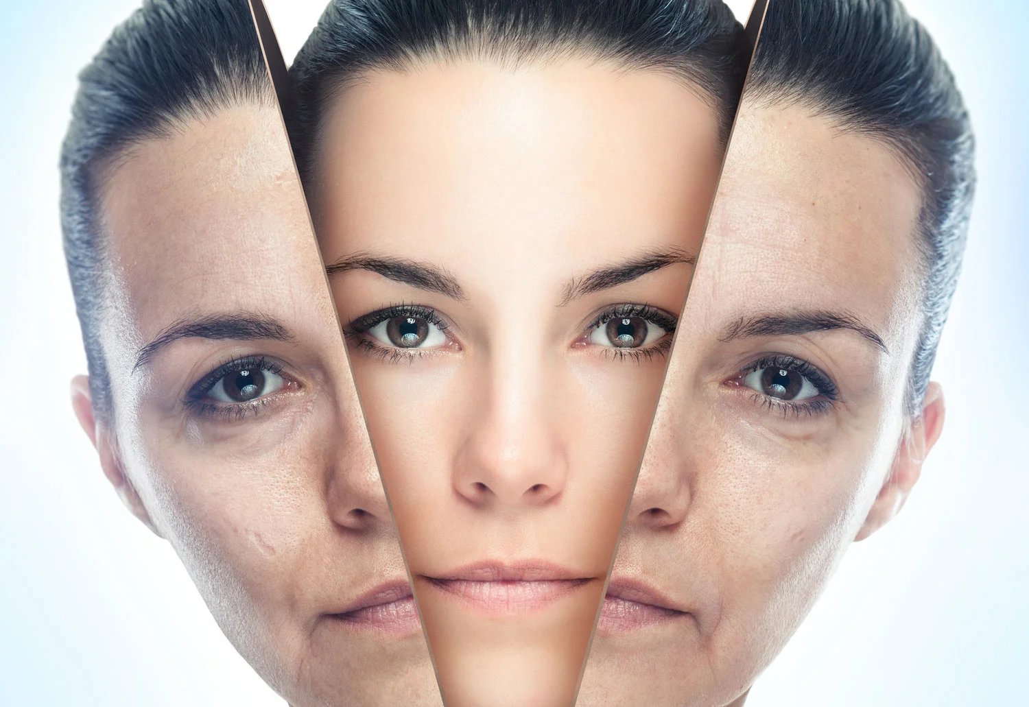 Amazing anti-aging treatment results